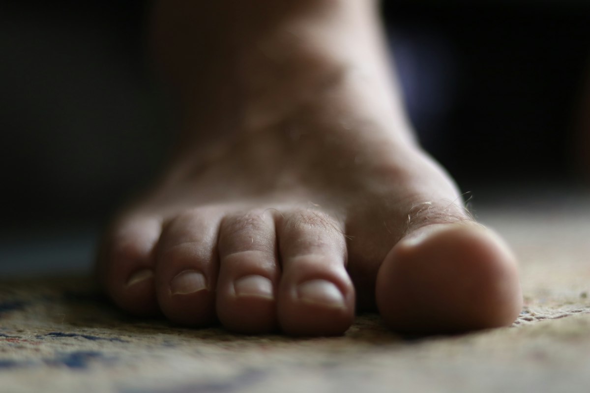 Perawatan Sensasi Kaki